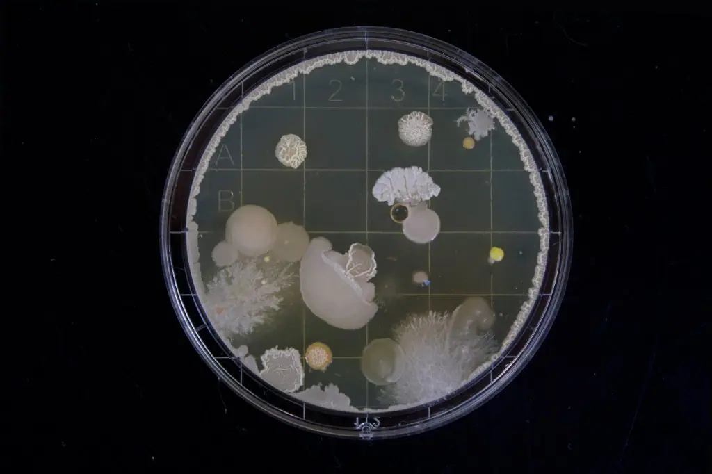 bacterias-virus-falta-de-lluvia