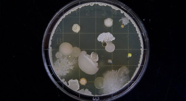 bacterias-virus-falta-de-lluvia