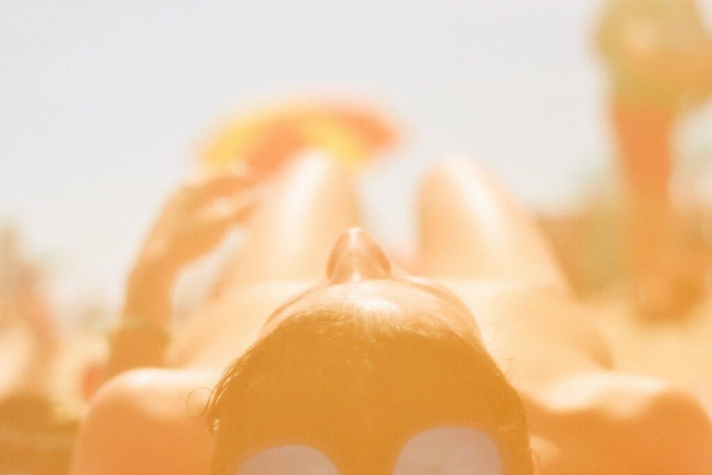 Se me pela la piel tras ponerla al sol
