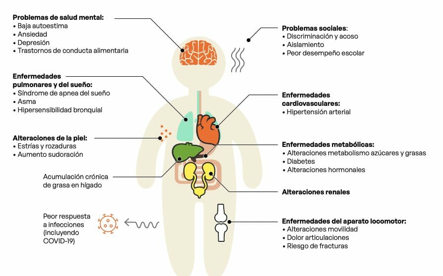 Representación cuerpo niño y problema de salud en la obesidad infantil