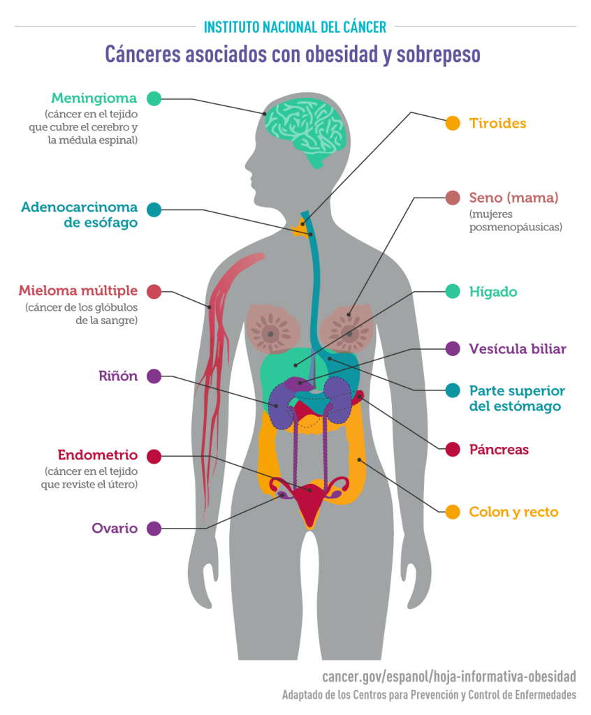 cancer asociado con obesidad y sobrepeso alimentación y nutrición