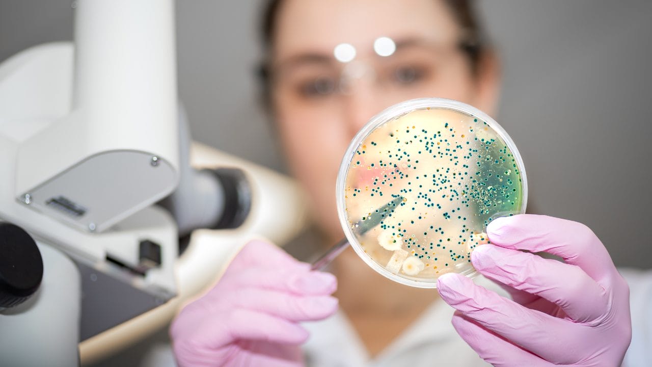 Qué son las bacterias? ¿Son las bacterias seres vivos? | Eltiempo.es