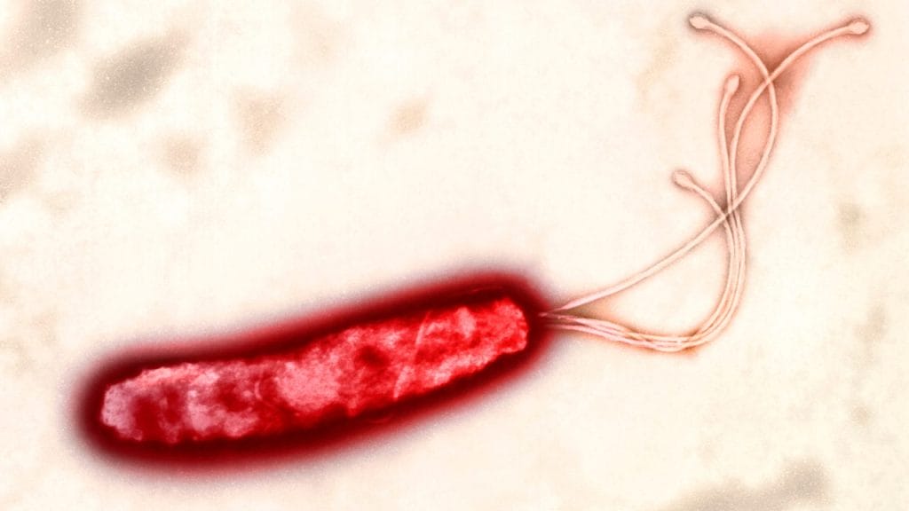 son las bacterias seres vivos, Bacteria Helicobacter pylori, , gram negativa,  espiral, flagelos,